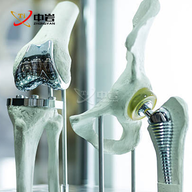 titanium rod medical